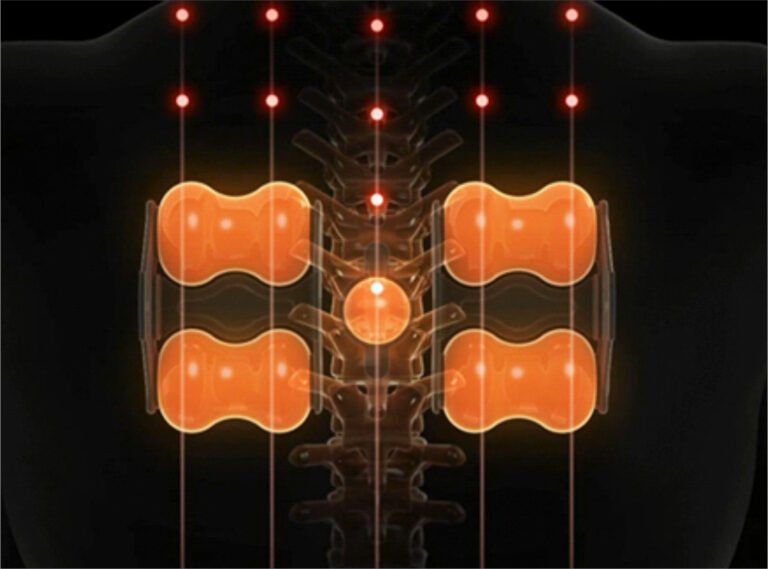 Ceragem Master V4 Termomasszázs